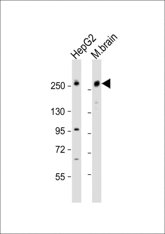 Polyclonal Rabbit anti-Human GARNL1 / RALGAPA1 Antibody (aa735-768, WB)
