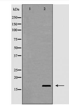 Polyclonal Rabbit anti-Human IL2 Antibody (WB)