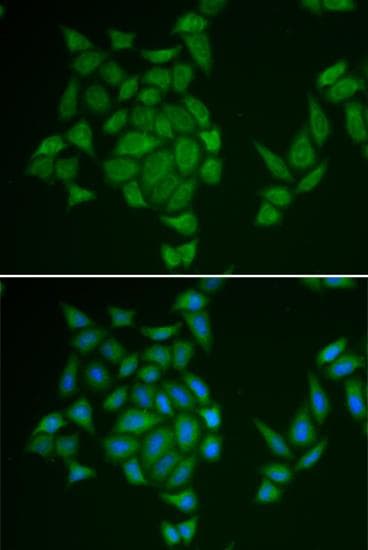 AMPD3 Antibody