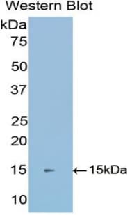 CDH1 / E Cadherin Antibody (aa153-264)