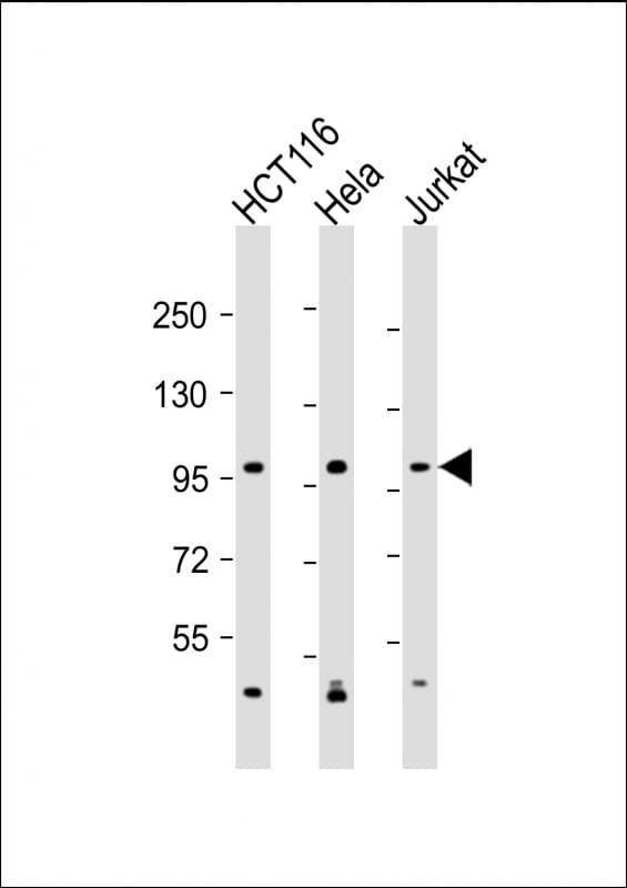 MANBA Antibody (C-Terminus)