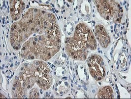 ACY1 / Aminoacylase 1 Antibody (clone OTI1D4)