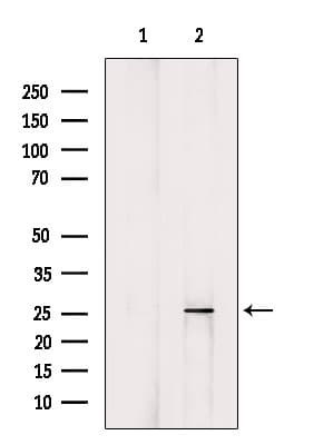 BTG1 Antibody