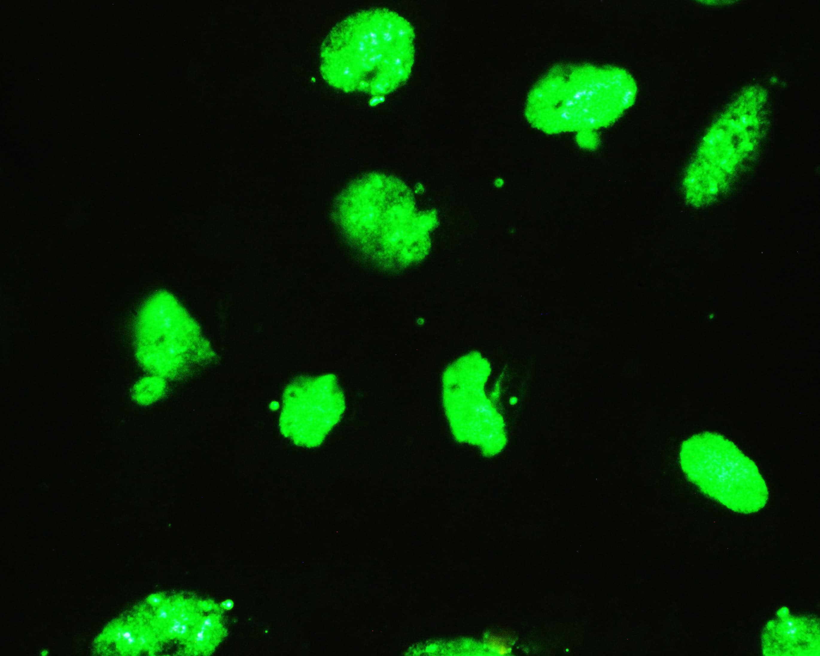 EWSR1 / EWS Antibody (aa369-399)