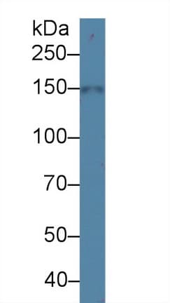 SLC12A3 / TSC Antibody (aa3-146)