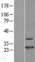CINP Protein (Over-Expression Lysate Myc-DDK (Flag))
