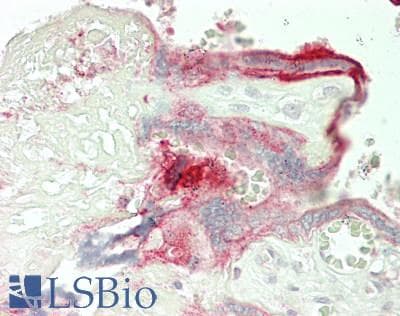 IHC-plus™ STK10 / LOK Antibody (aa481-530)