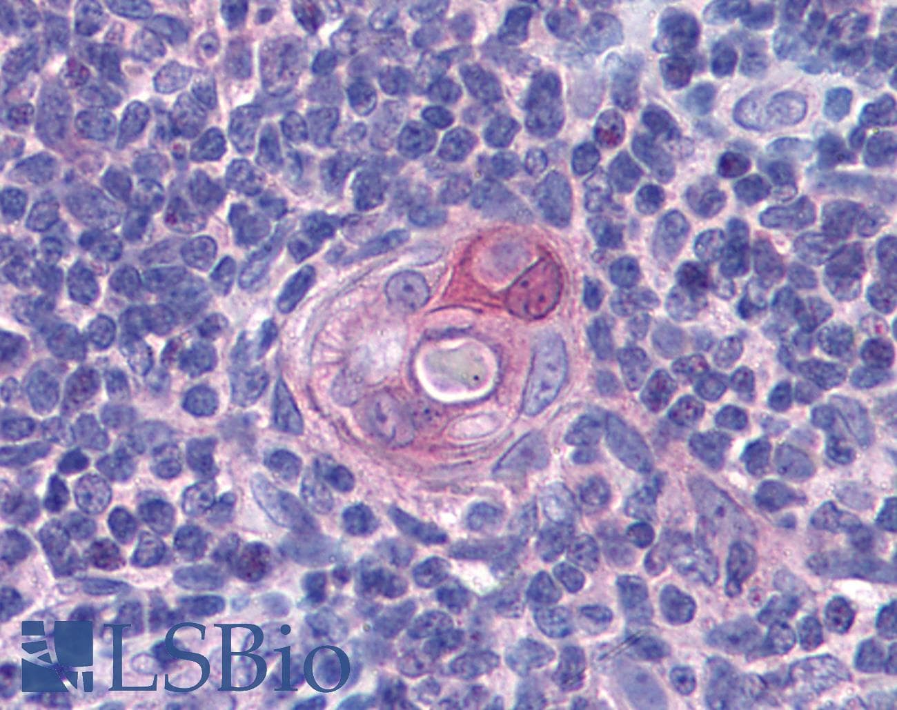 IHC-plus™ Polyclonal Rabbit anti-Human PYCARD / ASC / TMS1 Antibody (aa31-46, IHC, WB)