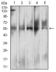 CLEC4M / L-SIGN / CD299 Antibody (clone 8A1B3)