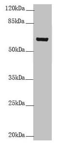 Polyclonal Rabbit anti-Human KRT6B / CK6B / Cytokeratin 6B Antibody (WB)