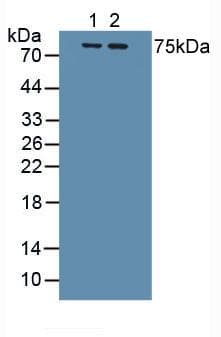 IL1R1 Antibody (aa120-208)
