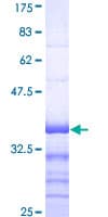 Human MNK / ATP7A Protein (Recombinant GST, N-terminus)
