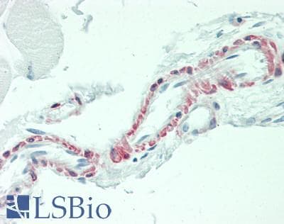 Polyclonal Rabbit anti-Human IL3 Antibody (aa20-152, IHC, WB)