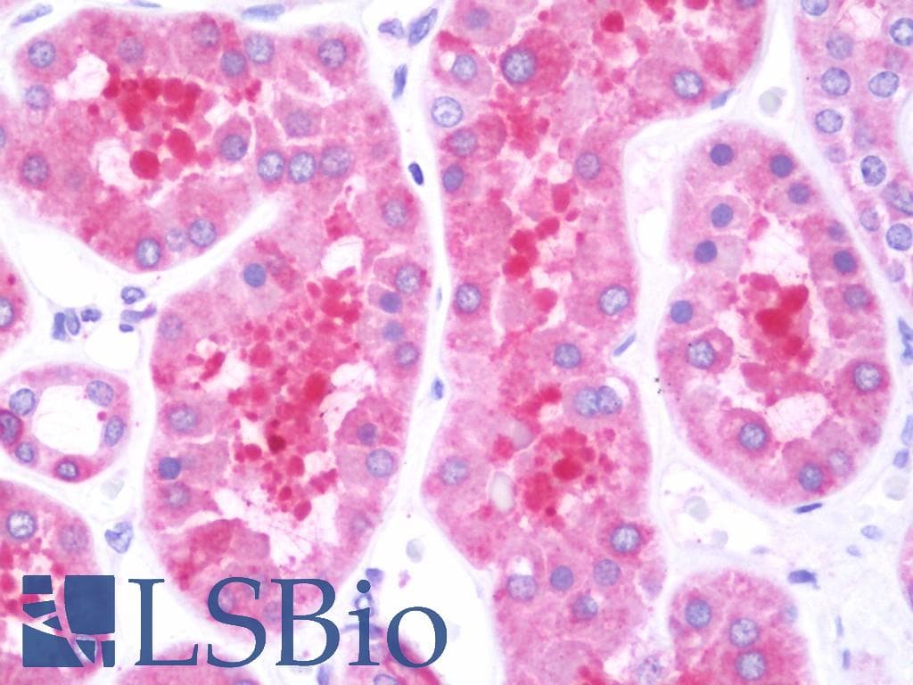 IHC-plus™ Polyclonal Rabbit anti-Human FKBP38 / FKBP8 Antibody (aa42-276, IHC)