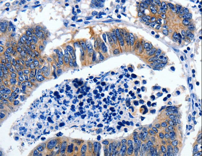 GAD65 Antibody