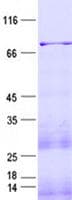 Human CHUK / IKKA / IKK Alpha Protein (Recombinant His, N-Terminal)