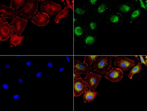 NME1 / NM23 Antibody (clone UMAB94)