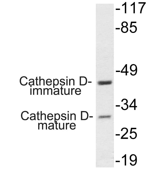 Polyclonal Rabbit anti-Human CTSD / Cathepsin D Antibody (aa296-345, IHC, WB)