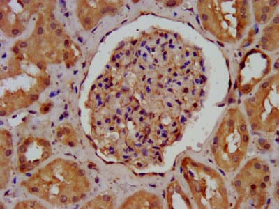 AGRN / Agrin Antibody