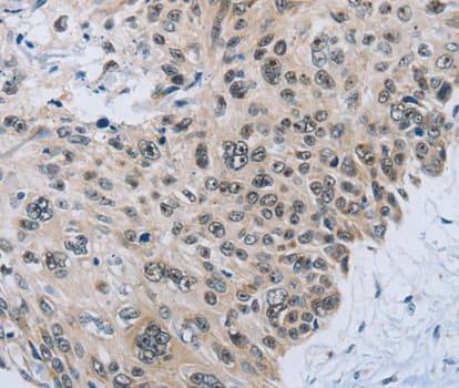 Polyclonal Rabbit anti-Human SLC16A4 Antibody (IHC, WB)