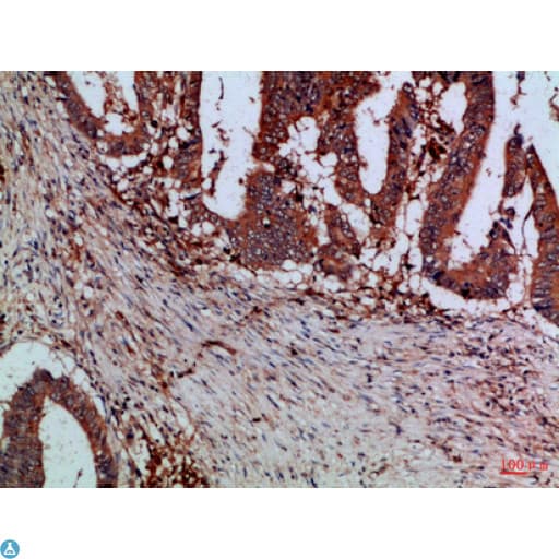 CSTB / Cystatin B / Stefin B Antibody