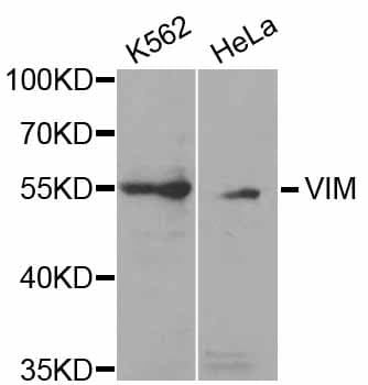 Vimentin Antibody