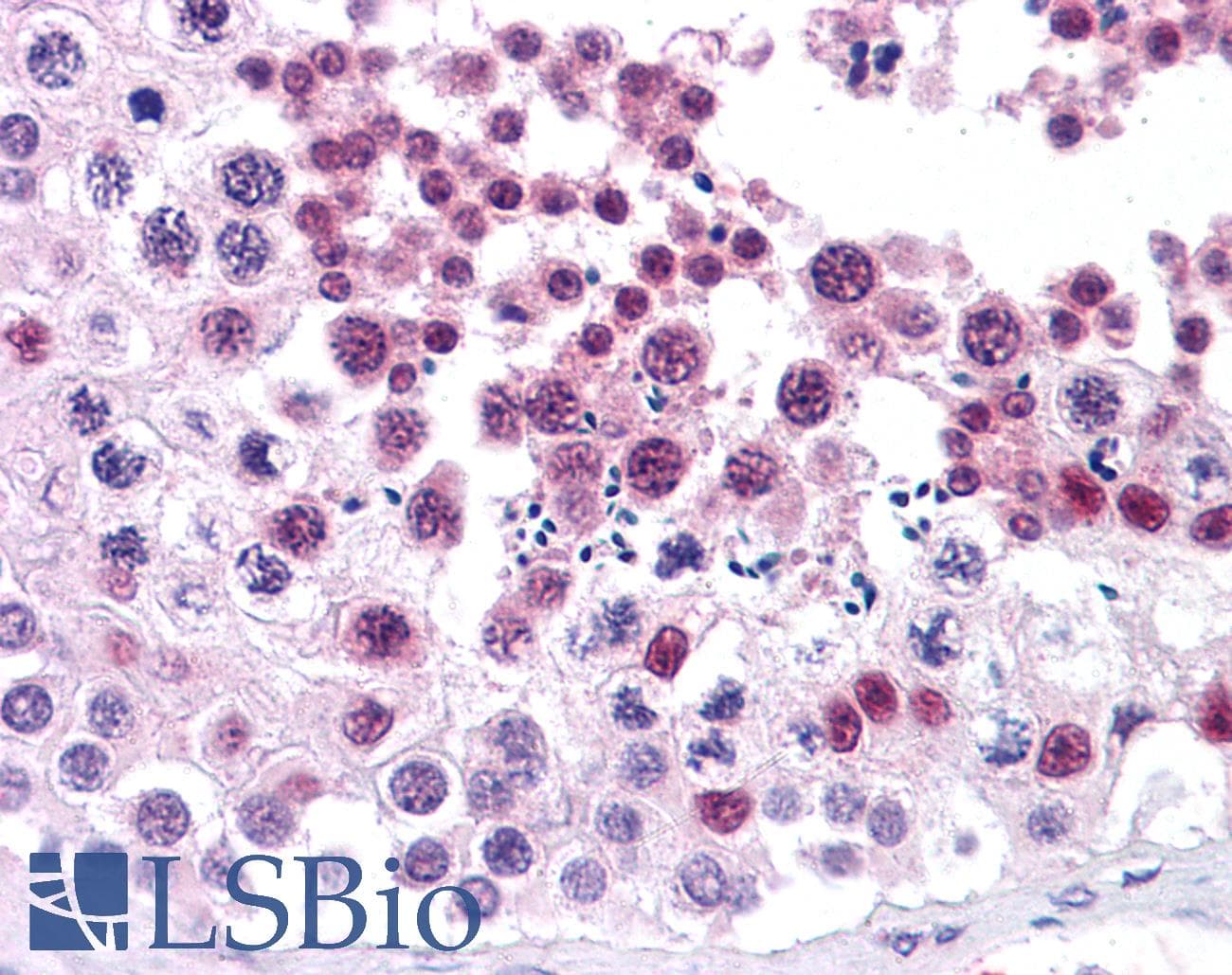 IHC-plus™ Monoclonal Mouse anti-Human MDM4 / MDMX Antibody (clone 2D10F4, aa 2-185, IHC, IF, WB)