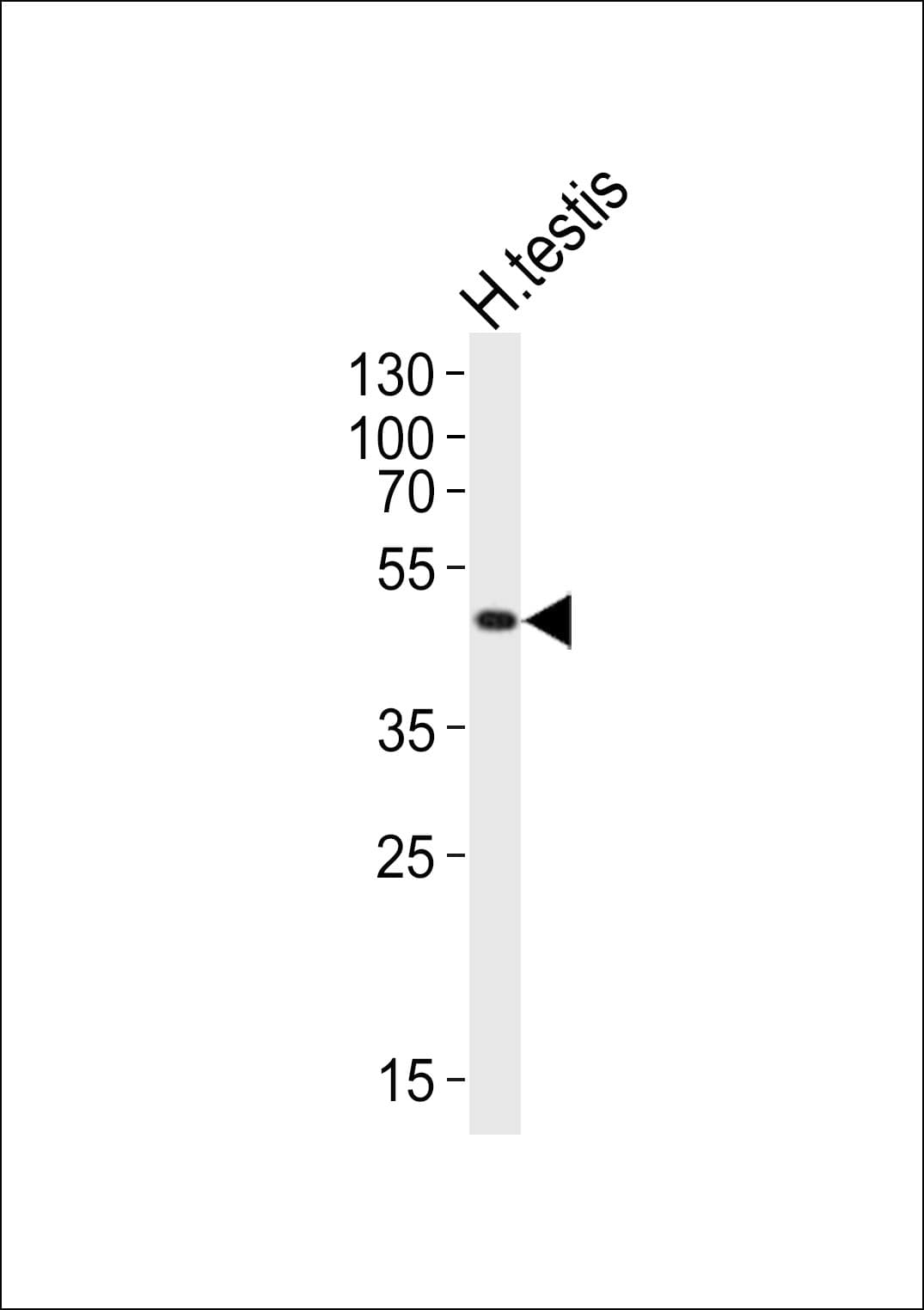 LIPI Antibody (aa224-258)