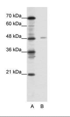 NF1A / NFIX Antibody (aa181-230)