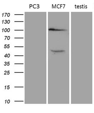 Monoclonal Mouse anti-Human AR / Androgen Receptor Antibody (clone OTI1D3, aa420-659, IHC, WB)
