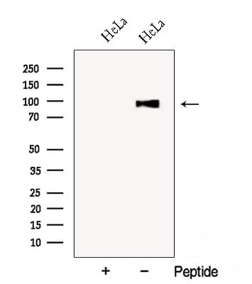 Polyclonal Rabbit anti-Human COG3 Antibody (WB)