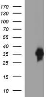 EPCAM Antibody (clone OTI2B6)