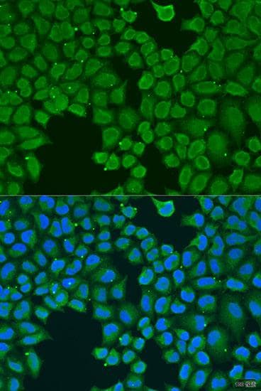 VG5Q / AGGF1 Antibody