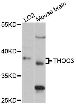 Polyclonal Rabbit anti-Human THOC3 Antibody (WB)