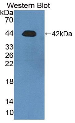 RTKN / Rhotekin Antibody (PE)