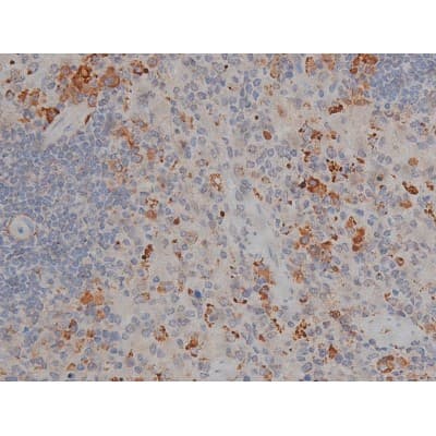 MAPT / Tau Antibody (phospho-Thr231)