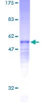 Human RCAN3 / Calcipressin 3 Protein (Recombinant GST)