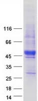 Human PRICKLE4 Protein (Recombinant Myc-DDK (Flag))