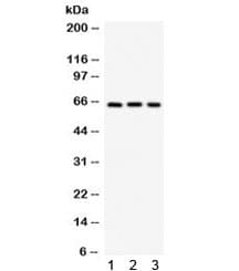 Polyclonal Rabbit anti-Human SPP1 / Osteopontin Antibody (WB)