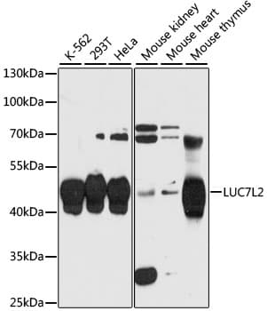 Polyclonal Rabbit anti-Human LUC7L2 Antibody (WB)