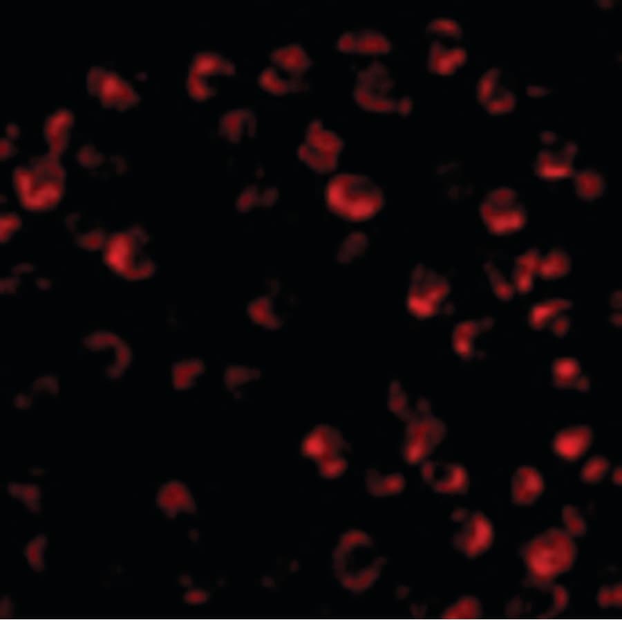 IHC-plus™ Polyclonal Rabbit anti-Human BCL2L11 / BIM Antibody (IHC, IF, WB)