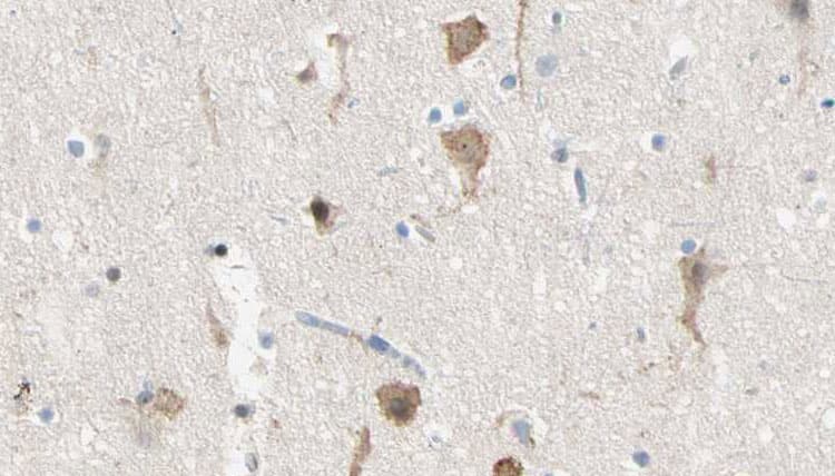 DENN / MADD Antibody