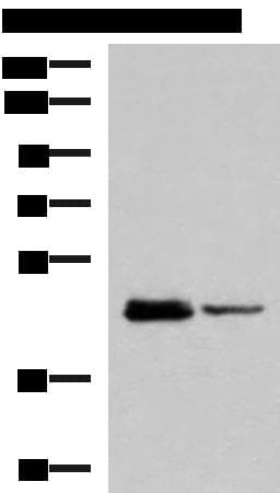 Polyclonal Rabbit anti-Human DDI2 Antibody (IHC, WB)
