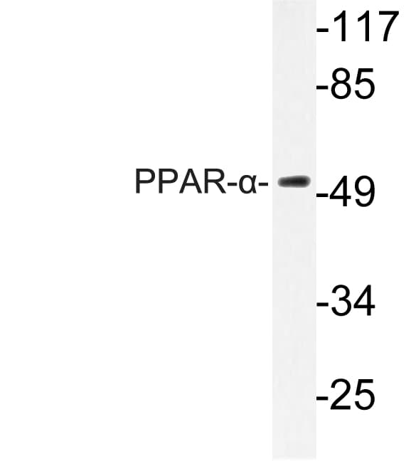 Polyclonal Rabbit anti-Human PPARA / PPAR Alpha Antibody (Gly17, WB)