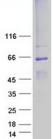 Human BEST1 / BEST / Bestrophin Protein (Recombinant Myc-DDK (Flag))