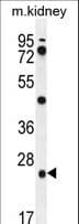 PGPEP1 Antibody (aa22-51)