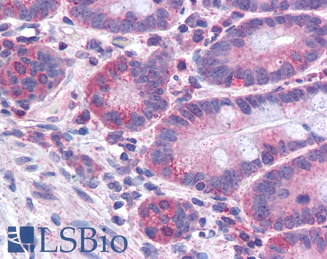 IHC-plus™ ACSL4 / FACL4 Antibody (aa658-670)