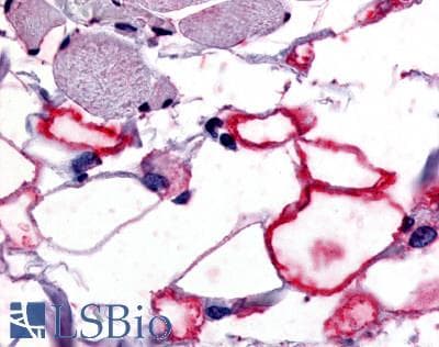 IHC-plus™ VIPR1 Antibody (Cytoplasmic Domain)