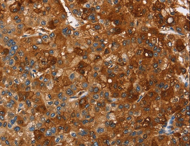 Polyclonal Rabbit anti-Human PAK2 Antibody (IHC, WB)