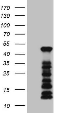 Monoclonal Mouse anti-Human SETD8 / SET8 Antibody (clone OTI2F5, IHC, WB)